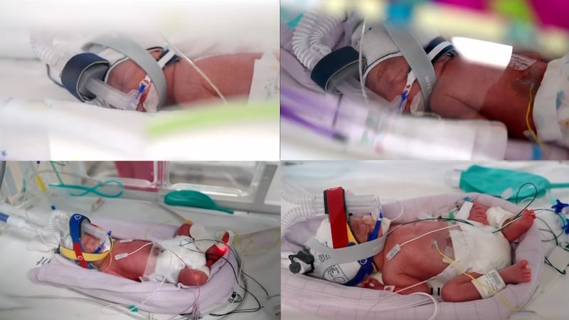 Too tiny for their parents’ arms just yet, identical quadruplets Emily, Harriet, Alexa and...
