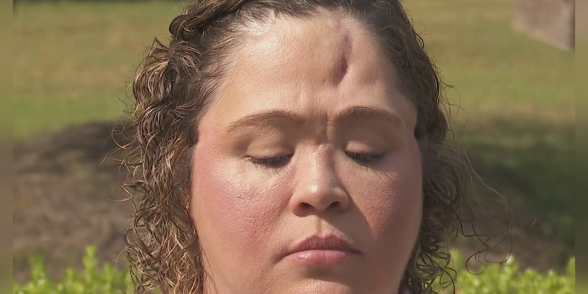 Calista Rice Attack Survivor of brutal attack shares story during Crime Victims’ Rights Week